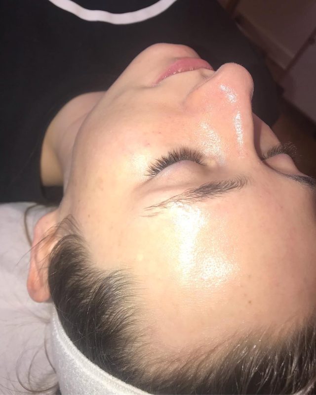 dermaplane facial treatment in warrington