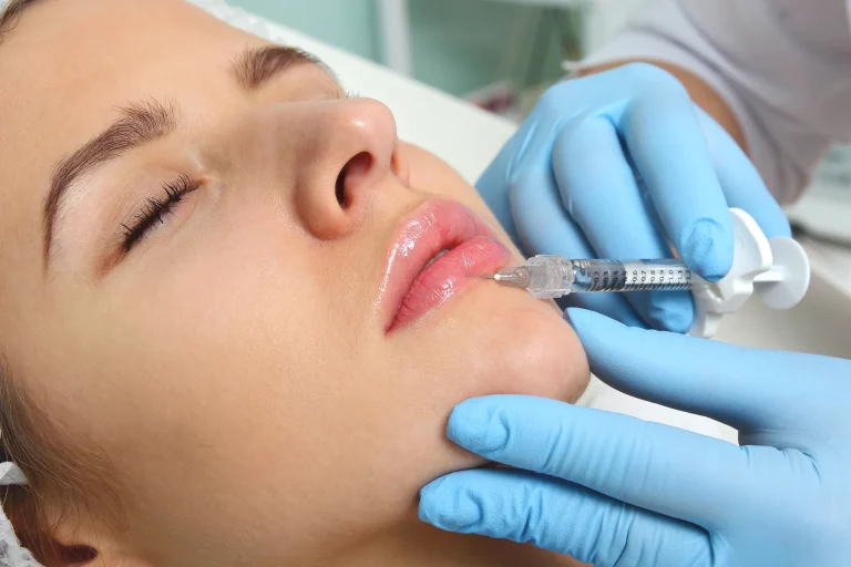 home of aesthetics lip filler treatment